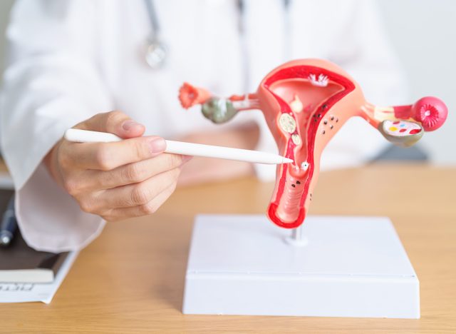 Doctor with Uterus and Ovaries anatomy model. Ovarian and Cervical cancer, Cervix disorder, Endometriosis, Hysterectomy, Uterine fibroids, Reproductive system, Pregnancy and health concept