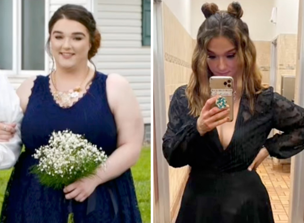 I Lost 160 Pounds Eating These High-Protein Snacks