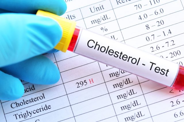 Blood sample tube with abnormal high cholesterol test result