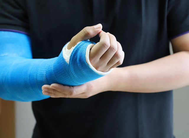 Closeup of asian man's arm with long arm plaster, fiberglass cast therapy cover by blue elastic bandage after sport accident. Appropriate treatment in western medicine.