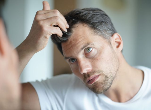 Portrait of a man worried about hair loss