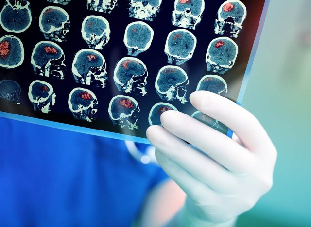 Doctor attentively examines the MRI scan of the patient.