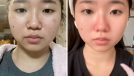 5 Tips to Lose Fat From Your Face, According to an Influencer