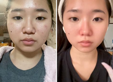 5 Tips to Lose Fat From Your Face, According to an Influencer