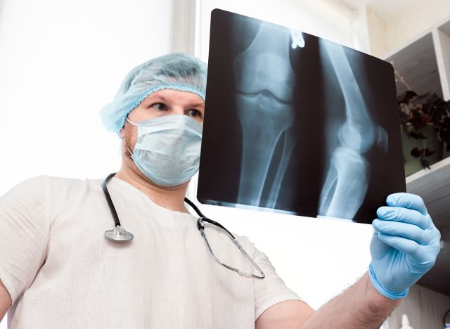 A doctor with a stethoscope, in a medical uniform in a clinic, a traumatologist analyzes a leg fracture. X-ray of the knee. Ultrasound. Injury of the leg in the knee joint. Osteoporosis