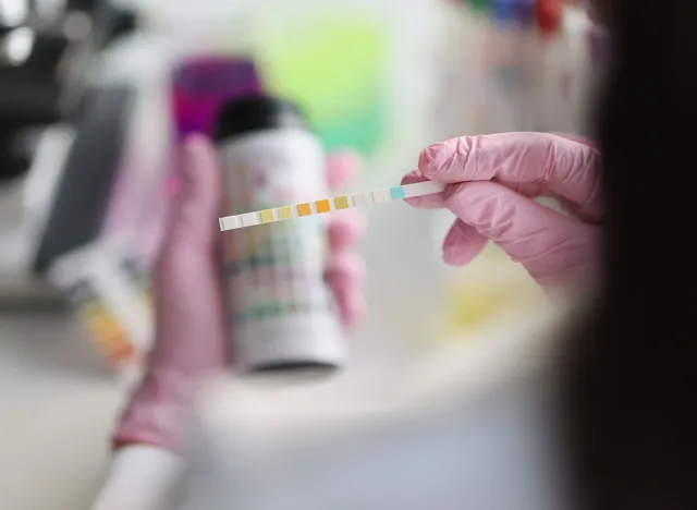 Gloved hands in the laboratory hold a litmus test strip, close-up, blurry. Bio samples for analysis. Ketones urine test