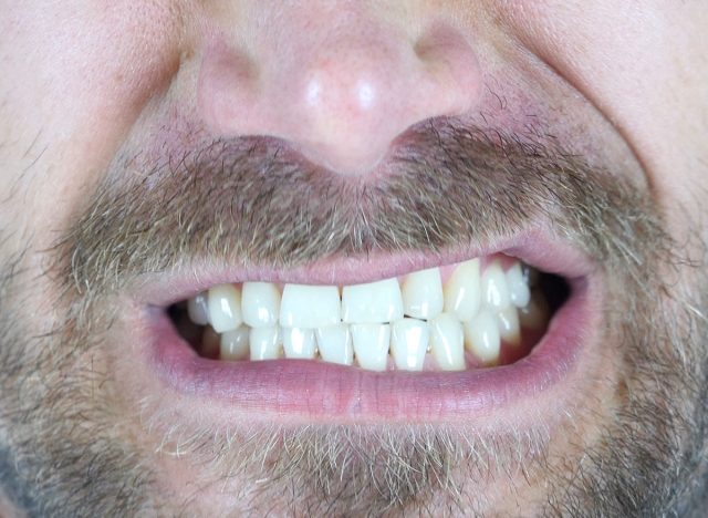 Angry Man Grinding Teeth, Close Up