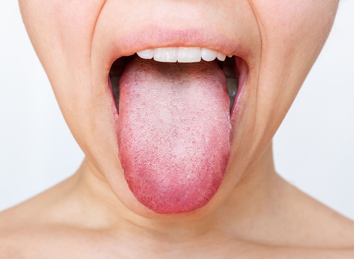 Female tongue with a white plaque. Cropped shot of a young woman showing tongue isolated on a white background. Digestive tract disease, organ dysfunction, poor oral hygiene, fungal infections