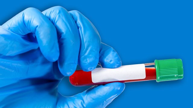 Doctor holding virus blood test tube