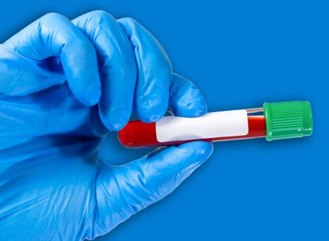 Doctor holding virus blood test tube